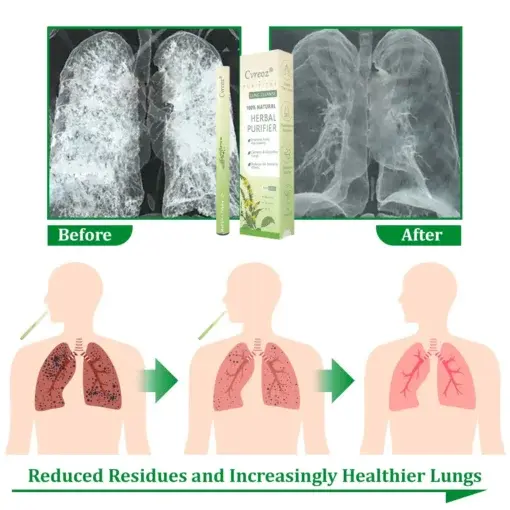 ๐๐ฎ๐ฅ๐ฅ๐๐ข๐ง ๐๐๐ซ๐๐๐ฅ ๐๐ฎ๐ง๐ ๐๐ฎ๐ซ๐ข๐๐ข๐๐ซ