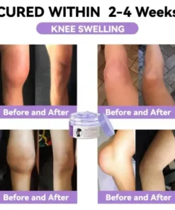 7 Day Rapid Joint & Bone Therapy Cream