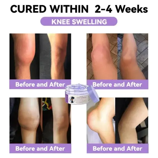 7 Day Rapid Joint & Bone Therapy Cream