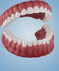 Advanced Customized Full Denture Set