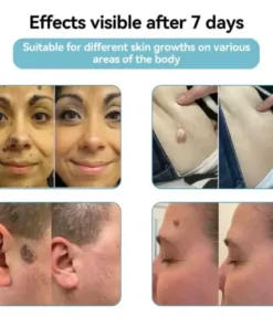 All-in-One CO₂ Laser Eraser Pen