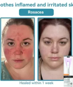 All-in-One Laser Eraser Pen