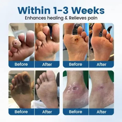 AngioVita Diabetic Care Spray