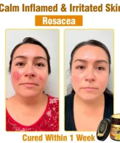 Bee Venom All-in-One Cream