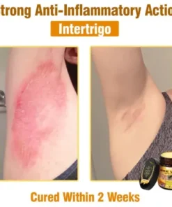 Bee Venom All-in-One Cream