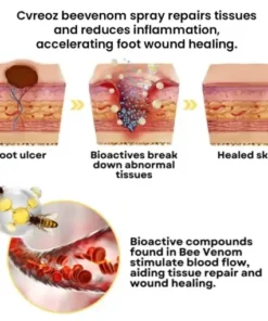 Bee Venom Diabetic Foot Treatment Spray