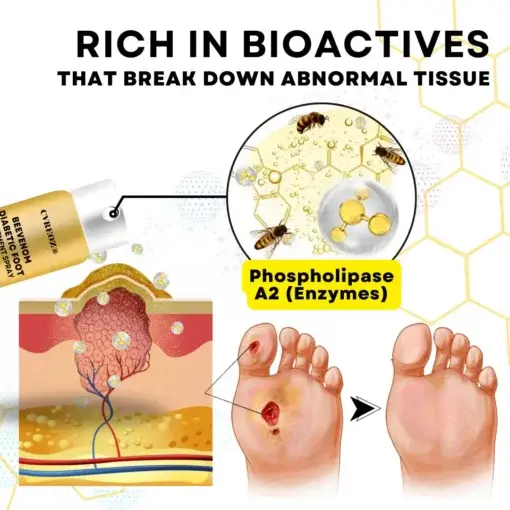 Bee Venom Diabetic Foot Treatment Spray