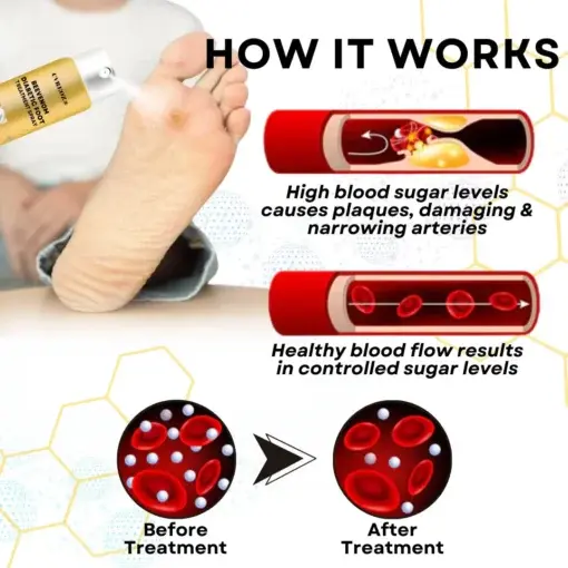 Bee Venom Diabetic Foot Treatment Spray