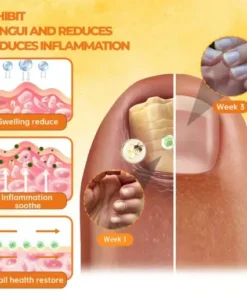 Bee Venom Nail Renewal Spray