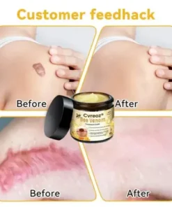 Bee Venom Skin Treatment Cream