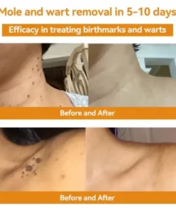 Bee Venom Skin Treatment Cream