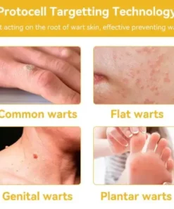 Bee Venom Skin Treatment Cream