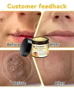 Bee Venom Skin Treatment Cream