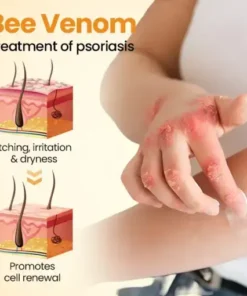 BeeLieve Psoriasis Skin Care