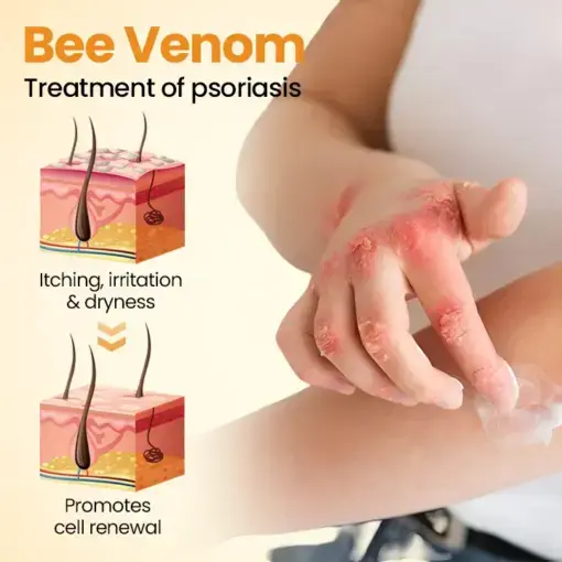 BeeLieve Psoriasis Skin Care