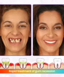 BeeRenew Advanced Gum Healing Toothpaste