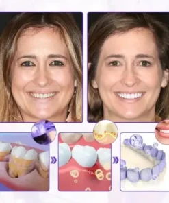 BeeRenew Advanced Gum Healing Toothpaste