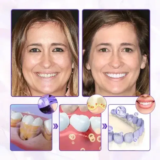 BeeRenew Advanced Gum Healing Toothpaste