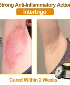 Botox Bee Venom Rapid Skin Repair Cream