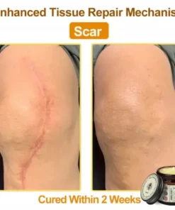 Botox Bee Venom Rapid Skin Repair Cream