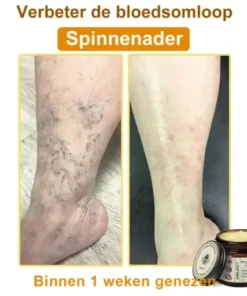 Botox Bee Venom Rapid Skin Repair Cream