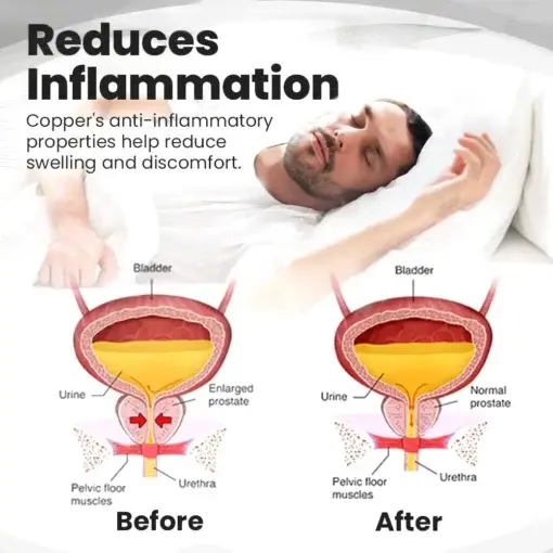 Copper Mag Prostate Therapy Ring