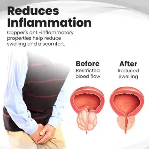 Copper Mag Prostate Therapy Ring