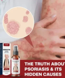 DermSoothe Psoriasis Relief Spray