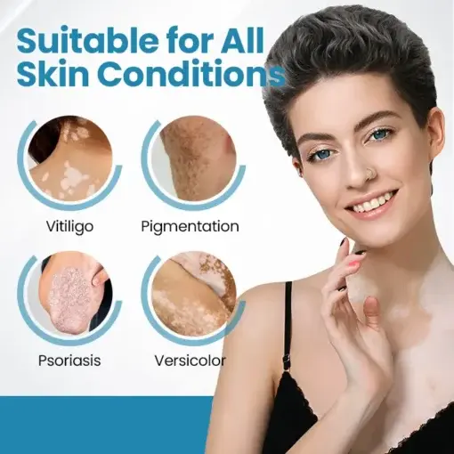 DermaBeam Vitiligo Therapy device