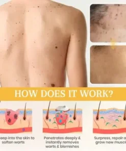 DermaErase Advanced Mole & Spot Removal Gel