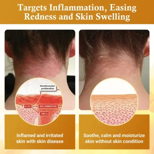 DermaFix Condense Mellifera Venom Skin Repairing Cream