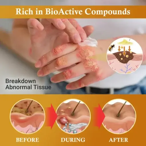 DermaFix Condense Mellifera Venom Skin Repairing Cream