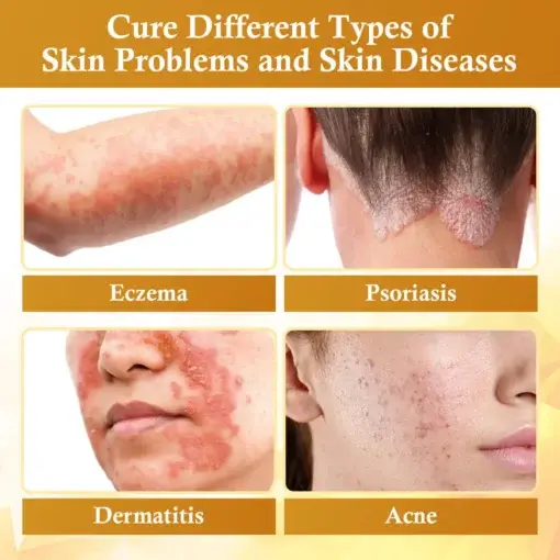 DermaFix Condense Mellifera Venom Skin Repairing Cream