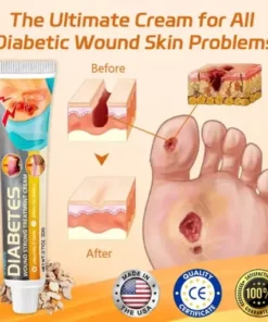 Diabetes Wound Strong Treatment Cream