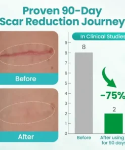 EliteAloe ScarSolve Spray