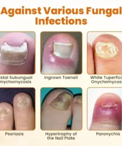 FungiBee Advanced Nail Repair Spray