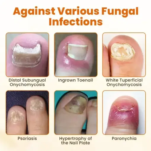 FungiBee Advanced Nail Repair Spray