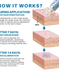 Genital Warts Relief Cream