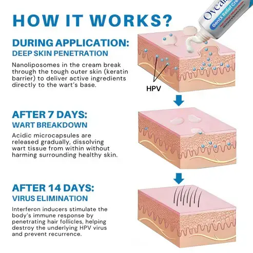 Genital Warts Relief Cream