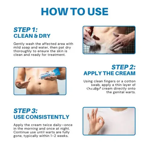 Genital Warts Relief Cream