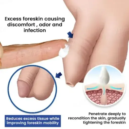 Glans Whitening & Foreskin Corrector Cream
