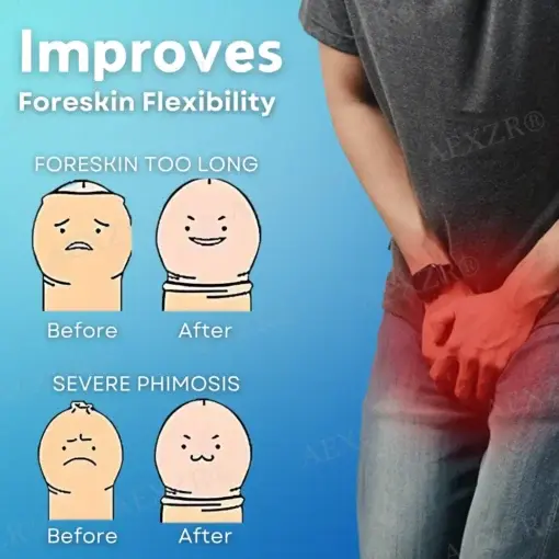 Glans and Foreskin Care Cream