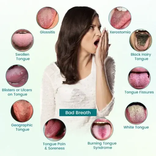 GlosShield Tongue Repair Spray