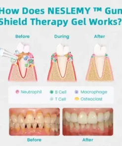 Gum Shield Therapy Gel
