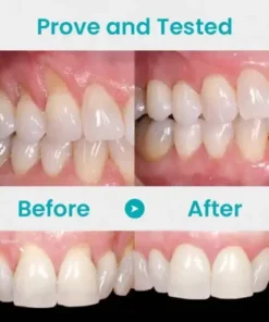 Gum Shield Therapy Gel