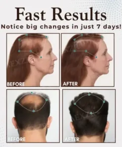 Hair Regrowth Capsules