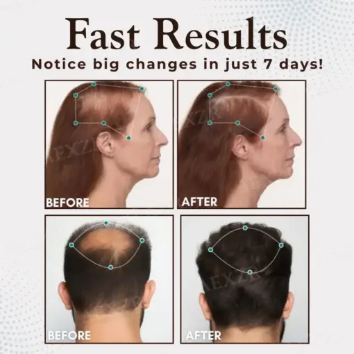 Hair Regrowth Capsules
