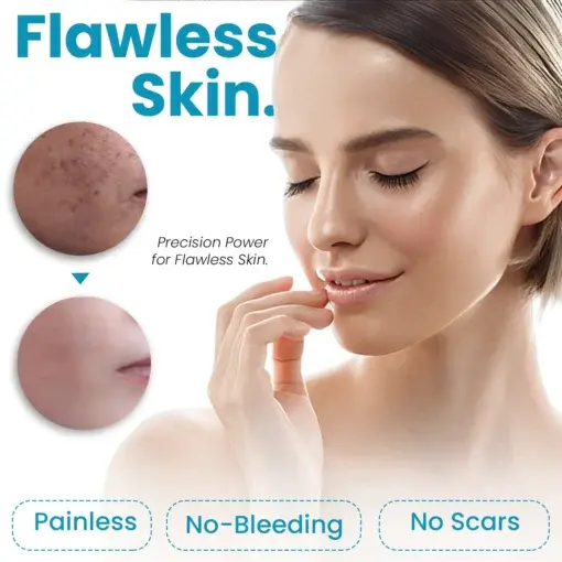 Home Use CO2 Laser Shot Erase Pro