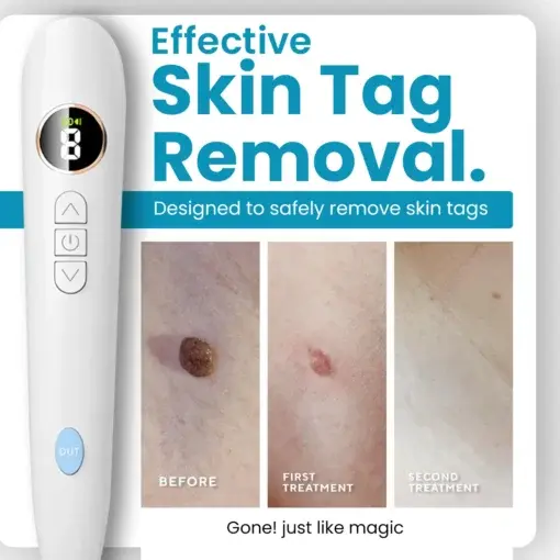 Home Use CO2 Laser Shot Erase Pro