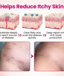 IntiDefend Anti-HPV Interferon Gel